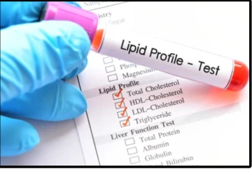 Lipid profile image